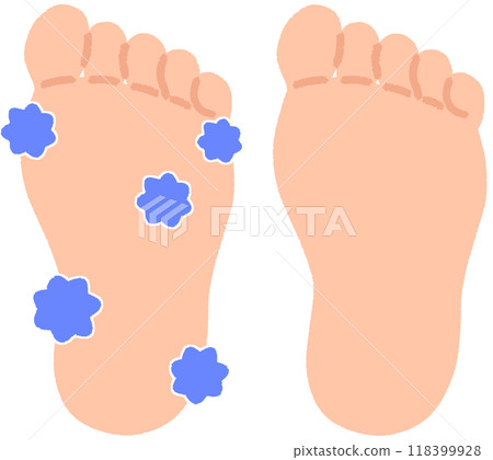 充滿真菌的腳和乾淨的腳 118399928