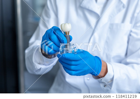 Unrecognizable doctor holding dental layout of upper veneers of teeth prothesis 118411219