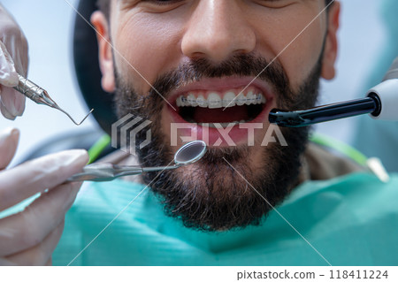 Orthodontic specialist using professional instruments to inspect teeth for caries and provide care 118411224