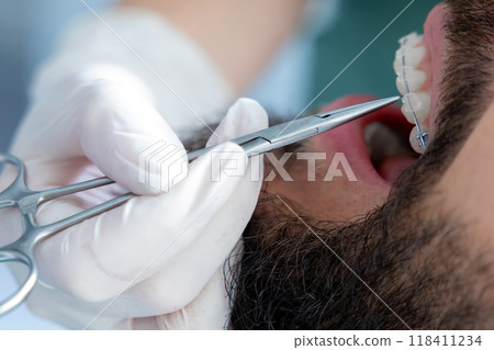 Orthodontic specialist using professional instruments to inspect teeth for caries and provide care Orthodontic specialist using professional instruments to inspect teeth for caries and provide care 118411234