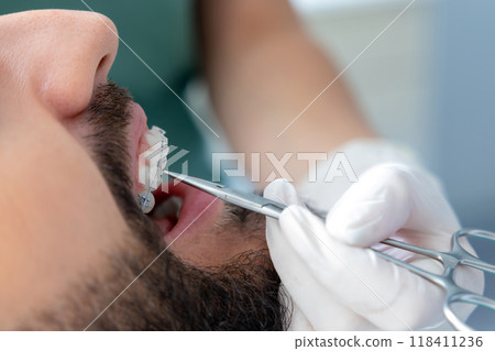 Professional mouth examination and dental treatment checkup in clinic Professional mouth examination and dental treatment checkup in clinic 118411236