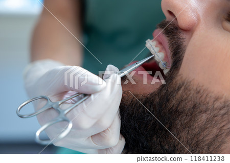 Orthodontic specialist using professional instruments to inspect teeth for caries and provide care 118411238