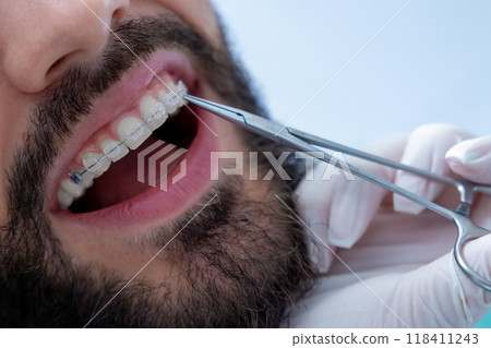 Dentist performing examination with specialized tools during routine dental checkup 118411243