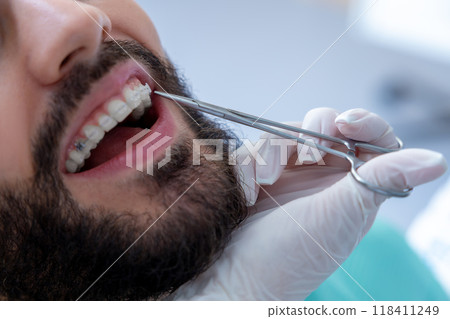 Medical professional oral checkup with dental equipment to examine the patient's mouth 118411249
