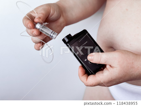 Person holding insulin pump and infusion set for diabetes management Person holding insulin pump and infusion set for diabetes management 118438955