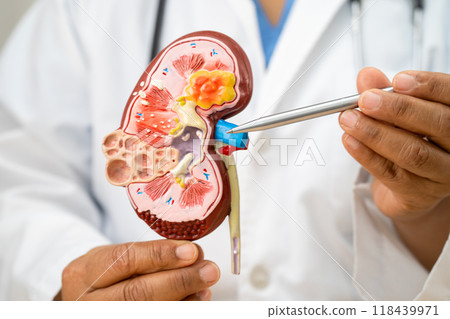 Kidney disease, Chronic kidney disease ckd, Doctor hold human model to treat and study in hospital. 118439971