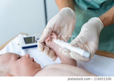 Unrecognizable doctor checking newborn baby's blood sugar level 118451100