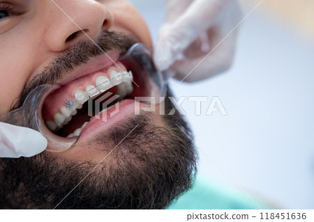 Medical professional oral checkup with dental equipment to examine the patient's mouth 118451636