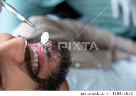 Medical professional oral checkup with dental equipment to examine the patient's mouth 118451638