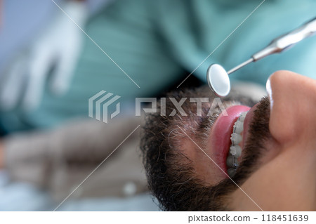 Professional mouth examination and dental treatment checkup in clinic 118451639