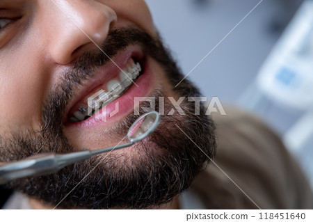 Man patient with with open mouth in dental clinic treating his teeth 118451640
