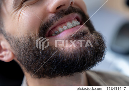 Smiling bearded man sitting in dental chair visiting dental clinic 118451647