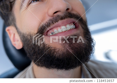 Bearded man patient visiting orthodontist for teeth whitening procedure and dental care Bearded man patient visiting orthodontist for teeth whitening procedure and dental care 118451657