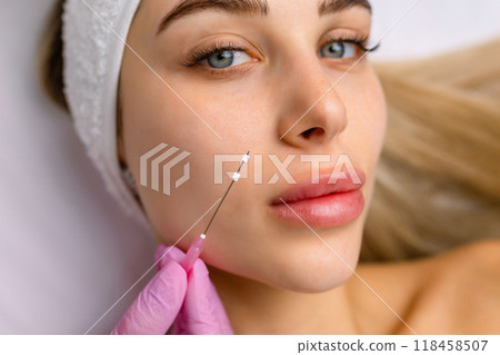 Face lifting PDO Suture operation. innovative technique of New thread lift, cosmetologist preparing to do procedure to female client, select the appropriate thread option Face lifting PDO Suture operation. innovative technique of New thread lift, cosmetologist preparing to do procedure to female client, select the appropriate thread option 118458507