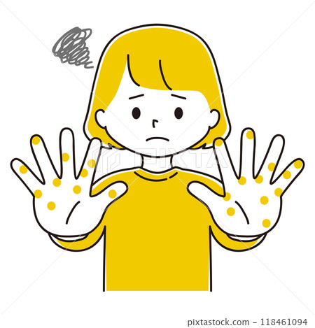 手上有濕疹的婦女的插圖 118461094