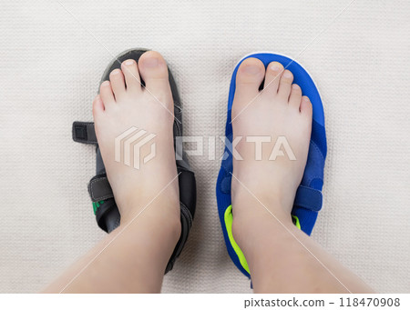 Children's anatomical shoes compared to narrow shoes that deform the foot. Small insole size, which causes foot pain. Barefoot sneakers with a wide toe 118470908