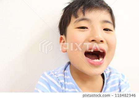Regeneration from deciduous teeth to permanent teeth Regeneration from deciduous teeth to permanent teeth 118482346