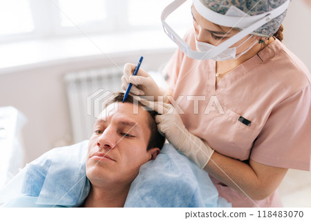 Closeup of female trichologist doctor marking hair line to male patient with hairloss problem, point of receding hair line for hair transplant surgery. Concept of baldness treatment. Closeup of female trichologist doctor marking hair line to male patient with hairloss problem, point of receding hair line for hair transplant surgery. Concept of baldness treatment. 118483070