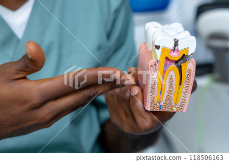 Model in the clinic displaying the structure of teeth, including enamel, dentine, and cementum Model in the clinic displaying the structure of teeth, including enamel, dentine, and cementum 118506163