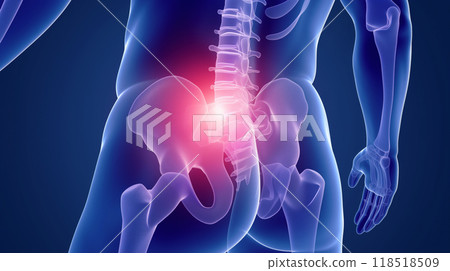 Visual representation of low back pain: An embodied image of pain and discomfort in the lumbar area. Visual representation of low back pain: An embodied image of pain and discomfort in the lumbar area. 118518509
