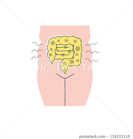 Unhealthy intestinal environment, intestines with a lot of bad bacteria, and obesity Unhealthy intestinal environment, intestines with a lot of bad bacteria, and obesity 118535110