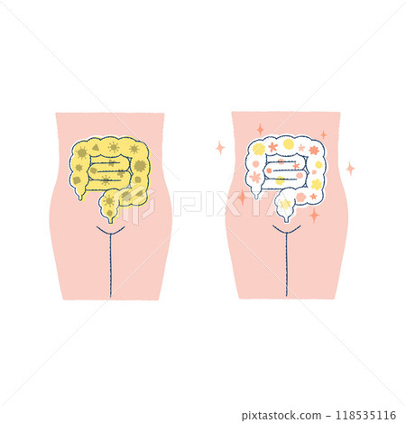Healthy intestinal environment / Unhealthy intestinal environment 118535116