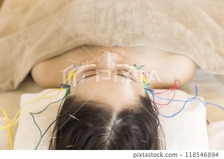 年輕女子做美容針灸 118546894