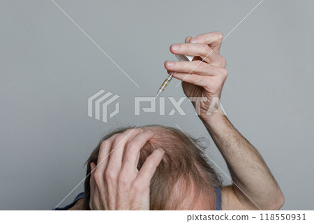 Bald man with minoxidil dropper or essential oil closeup 118550931