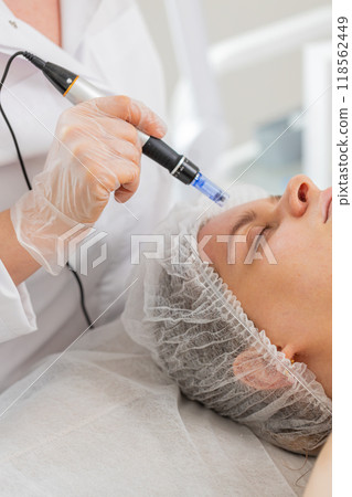 Cosmetologist doing peeling procedure, woman skin regeneration, dermapen microneedling, dermastamp 118562449