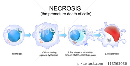 Necrosis. Uncontrolled cell death. Necrosis. Uncontrolled cell death. 118563086
