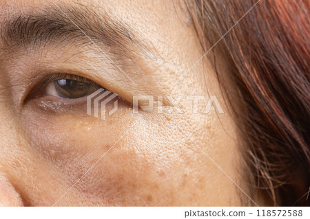 Senior asian woman worry about eye bags and dark spot. 118572588