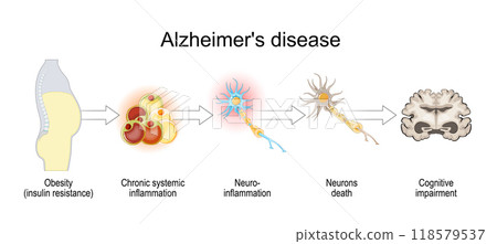 Alzheimers disease and insulin resistance. 118579537