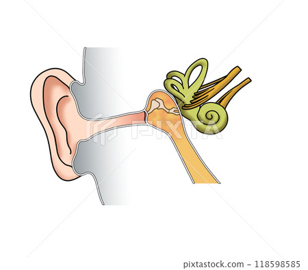 Acute otitis media (no text) 118598585