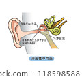 滲出性中耳炎（附文字） 118598588