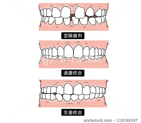 Teeth alignment that requires orthodontics Part 1 118598597