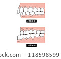 需要矯正治療的牙齒排列第3部分 118598599