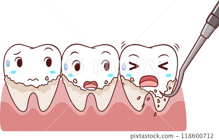 Illustration cartoon of removing tartar from the teeth. Illustration cartoon of removing tartar from the teeth. 118600712