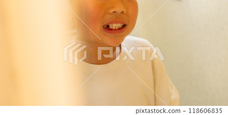 A 10-year-old boy is concerned about his missing lower baby teeth (canines) A 10-year-old boy is concerned about his missing lower baby teeth (canines) 118606835