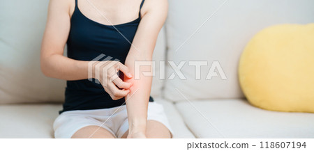 woman itching and scratching itchy arm. Sensitive Skin Allergic reaction to insect bite, food, drug dermatitis. Dermatology, Leprosy day, Systemic lupus erythematosus, Allergy symptoms and rash Eczema 118607194