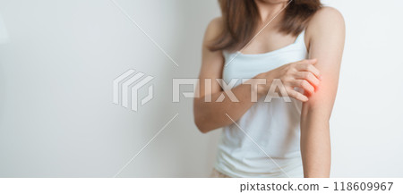 woman itching and scratching itchy arm. Sensitive Skin Allergic reaction to insect bite, food, drug dermatitis. Dermatology, Leprosy day, Systemic lupus erythematosus, Allergy symptoms and rash Eczema woman itching and scratching itchy arm. Sensitive Skin Allergic reaction to insect bite, food, drug dermatitis. Dermatology, Leprosy day, Systemic lupus erythematosus, Allergy symptoms and rash Eczema 118609967