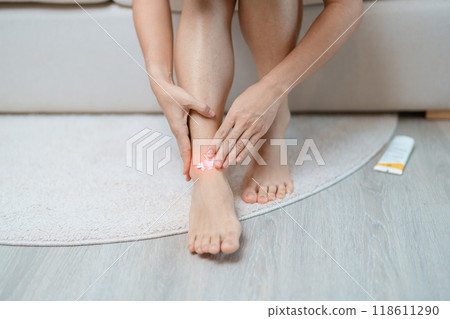 Arthritis and Muscle Pain Relief Cream concept. woman having leg pain due to Ankle Sprains or Achilles Tendonitis and Shin Splints ache. injuries, health and medical concept Arthritis and Muscle Pain Relief Cream concept. woman having leg pain due to Ankle Sprains or Achilles Tendonitis and Shin Splints ache. injuries, health and medical concept 118611290
