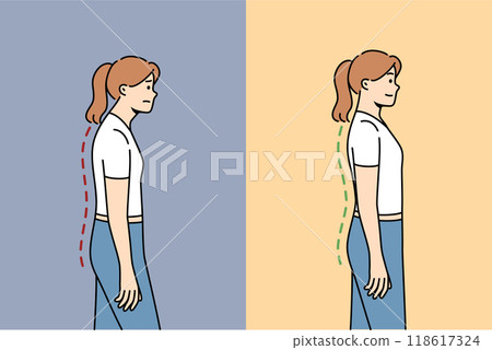 Scoliosis or osteochondrosis in woman, due to problems with posture and sore spine 118617324