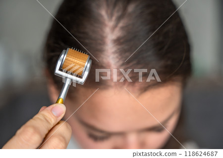 Close up view of young woman using microneedle derma roller on head for stimulating new hair growth in home. Treatment for the healthy scalp. Close up view of young woman using microneedle derma roller on head for stimulating new hair growth in home. Treatment for the healthy scalp. 118624687