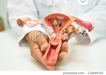 Uterus, doctor with anatomy model for study diagnosis and treatment in hospital. 118646381