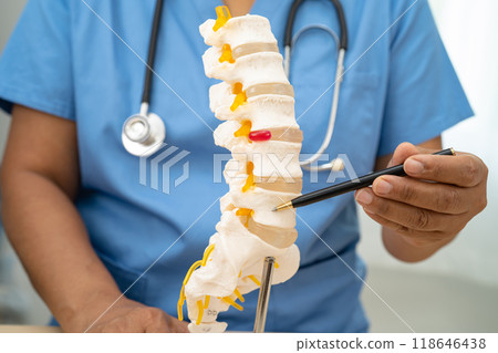 Doctor with lumbar vertebra bone skeleton and nerve model for treatment in the orthopedic department. Doctor with lumbar vertebra bone skeleton and nerve model for treatment in the orthopedic department. 118646438