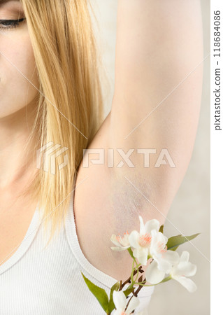 Woman showing armpit after electro epilation. Woman showing armpit after electro epilation. 118684086