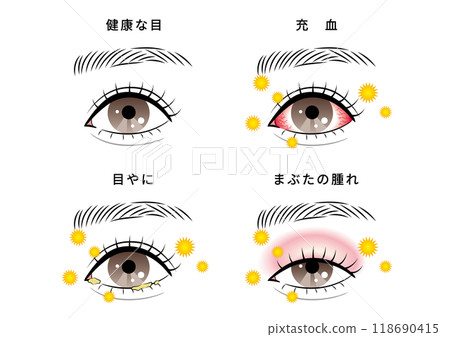 眼部問題套裝（花粉） 118690415