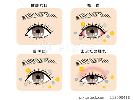 Eye trouble set (pollen and house dust) 118690418