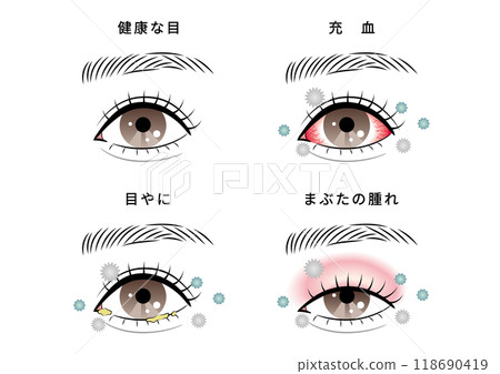 Eye trouble set (house dust) 118690419