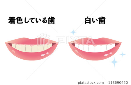 彩色牙齒和白色牙齒 118690430